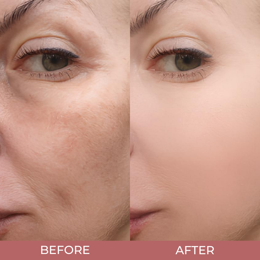 Duo Peel Shot Glow Rice Ampoule