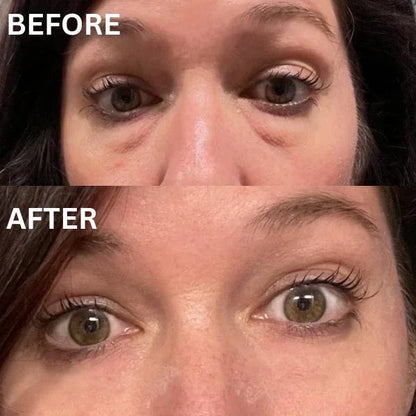 Instant Firm Collagen Eye Patches