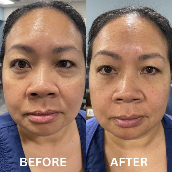 Instant Firm Collagen Eye Patches