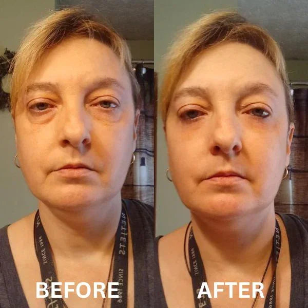 Instant Firm Collagen Eye Patches