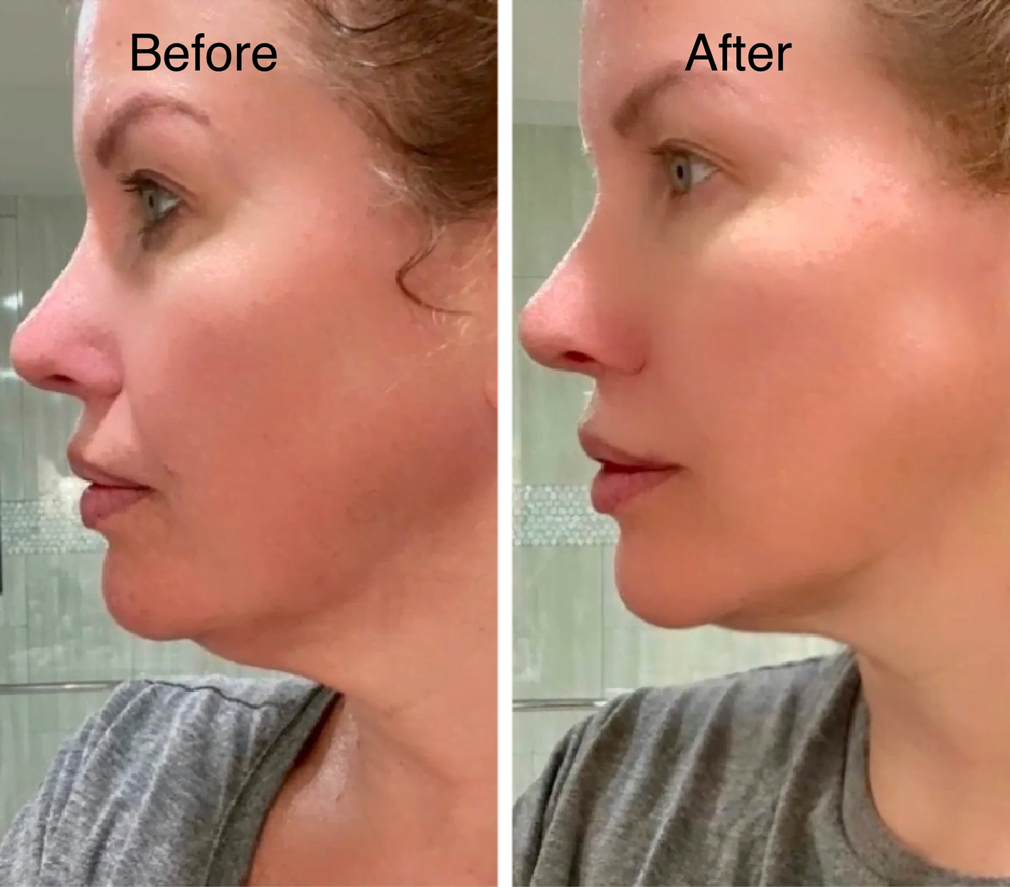 Lymphatic Face Brush + Free eBook