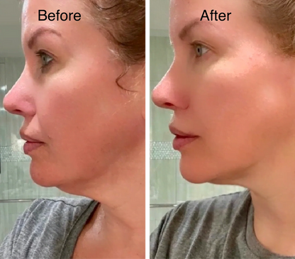 Lymphatic Face Brush + Free eBook